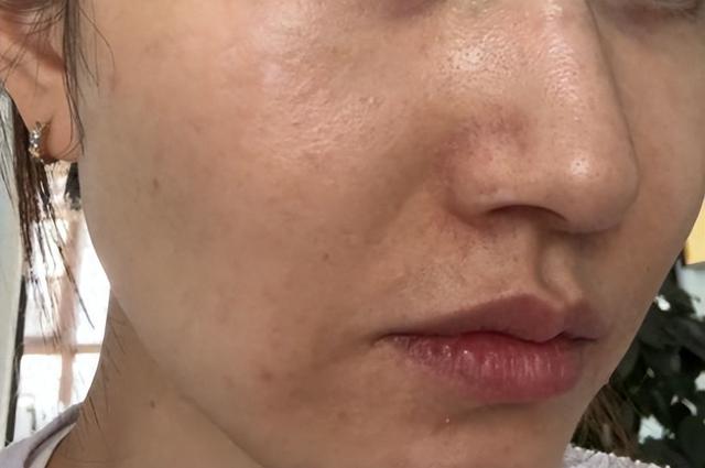 皮肤暗黄粗糙,推荐这几个方法,或能帮你改善