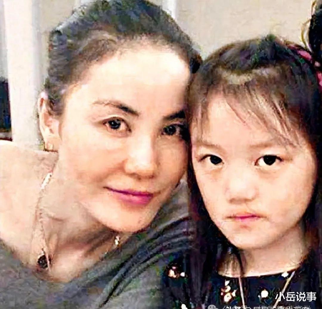 王菲花上百万为女儿治疗唇裂，嘴是治好了，脸感觉越来越奇怪!