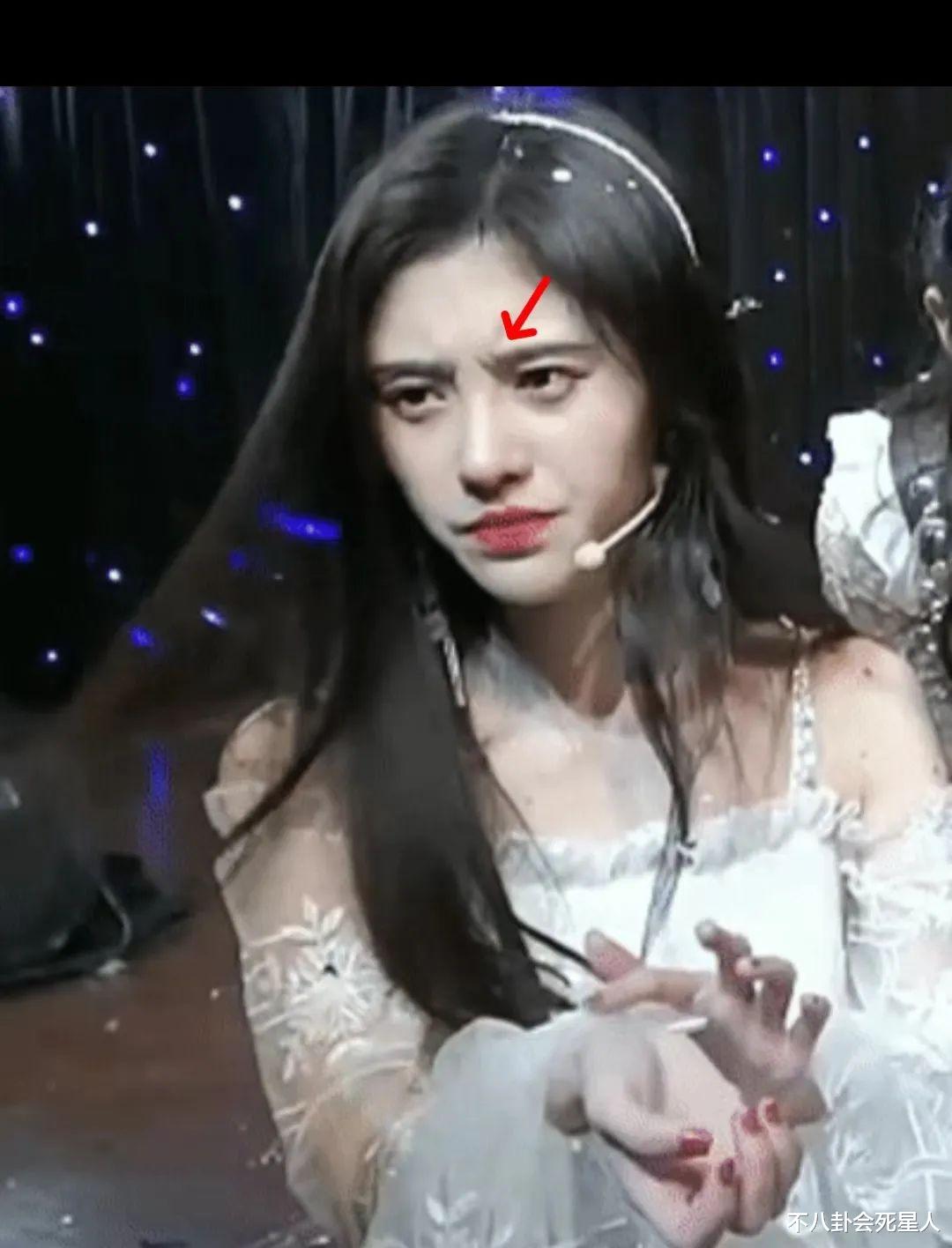 鞠婧祎近照变样,金莎脸僵浮肿,这6位明星动脸后遗症都出来了