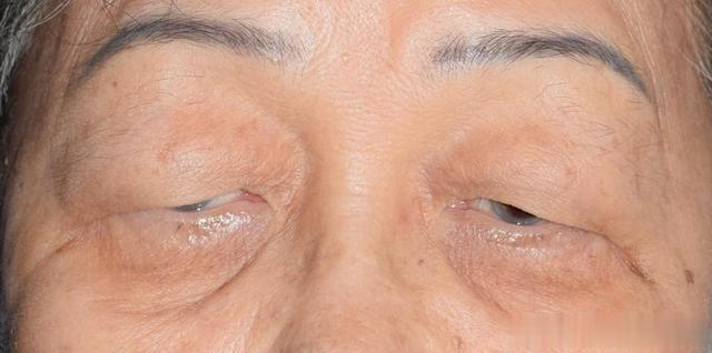 眼干，眼痒，怕光，记住这4盒中成药，清肝泻火，肝肾同补