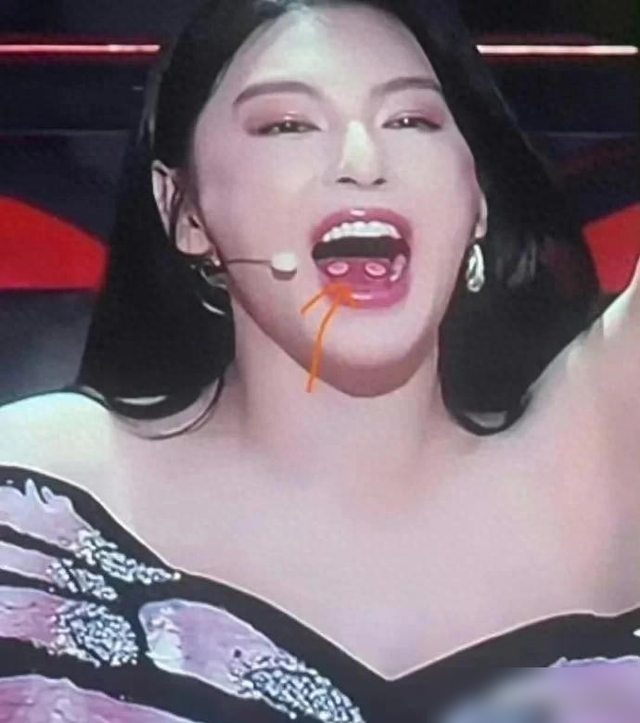 张雨绮舌头上这两坨东西惹争议,咋没见过这种西瓜霜啊