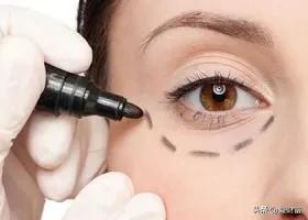 马应龙眼霜效果怎么样?马应龙眼霜去眼袋有效吗?