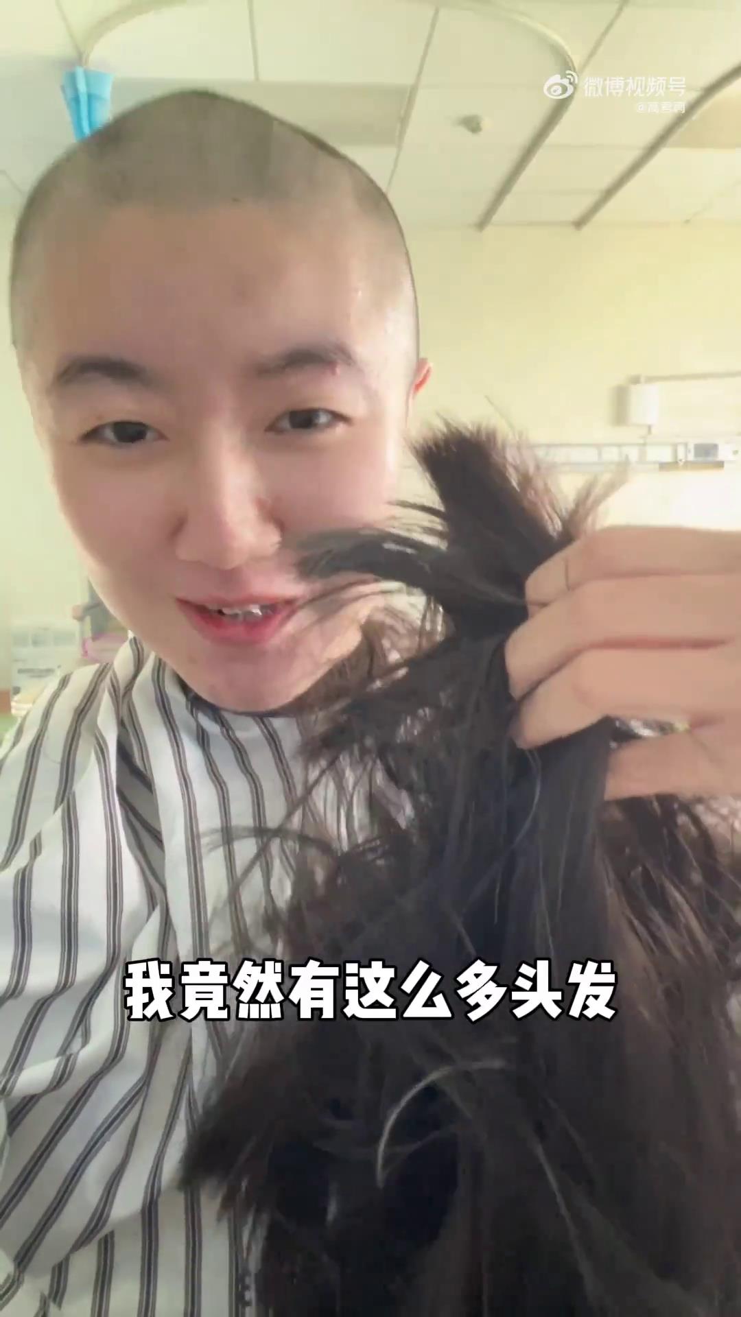 童星高君雨罹患脑瘤,开颅手术前拍剃光头视频,生病1年多次误诊