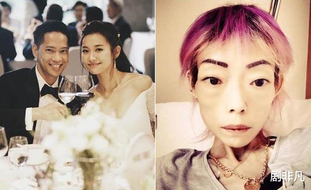 豪门玩物,8年被折磨到牙齿全掉,不足80斤,形似骷髅惨不忍睹!