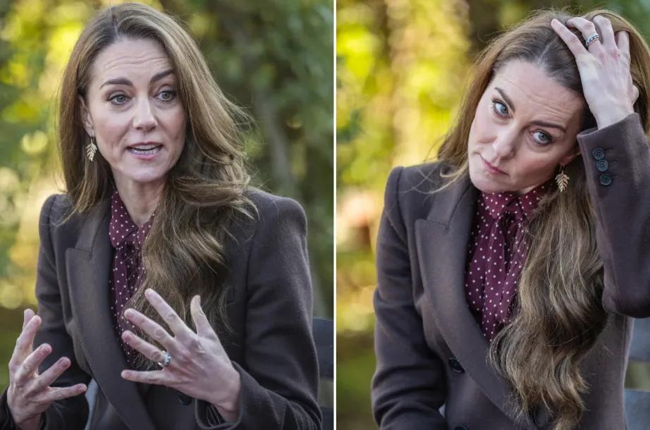 凯特王妃颜值大崩,脸垮得快,威廉王子跟着大变脸,竟是为了讨好老婆?