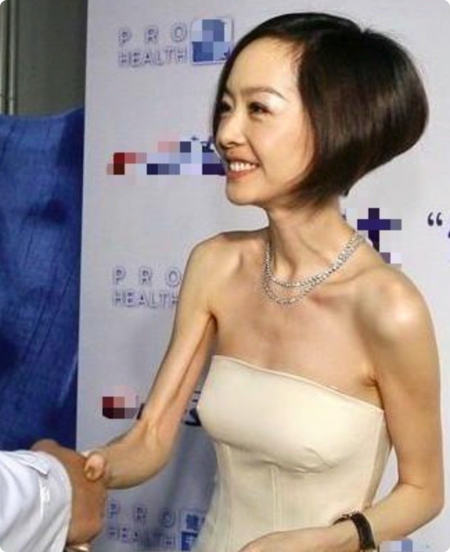 秃头脸凹,身瘦如柴,从吴谨言到金晨,被无效瘦身反噬的女星好多