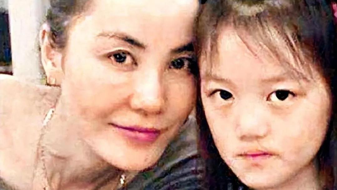 王菲花上百万为女儿治疗唇裂，嘴是治好了，脸感觉越来越奇怪!