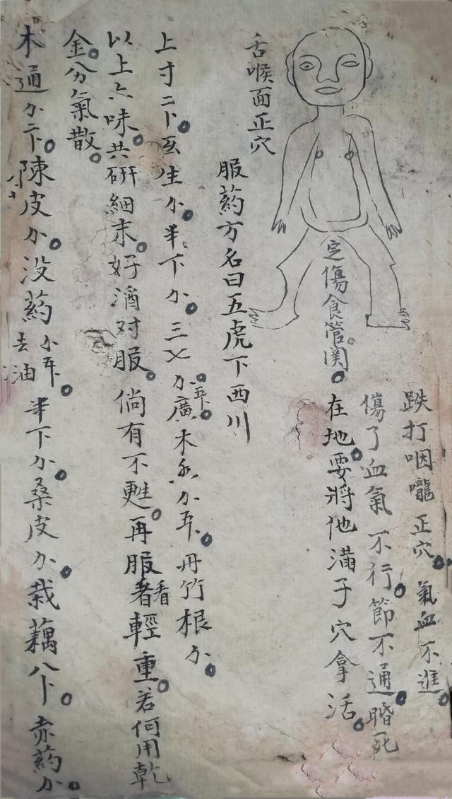 跌打损伤伤穴位秘方古书籍