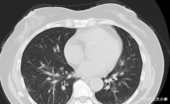 为了小玥儿小菻菻，张兰拼了！前儿媳不治而亡，是时候有个结论了