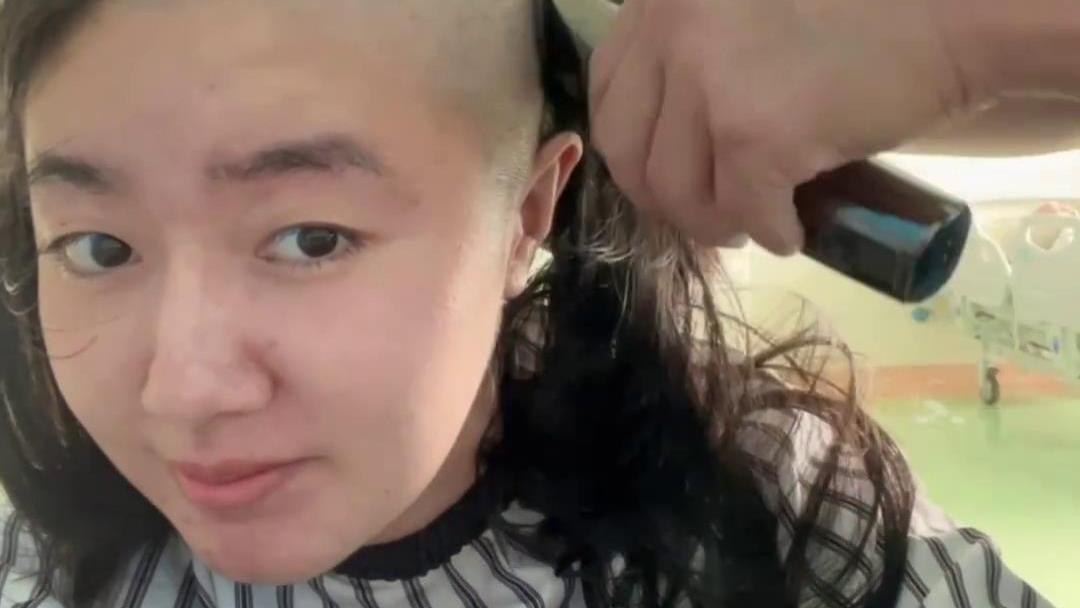 童星高君雨罹患脑瘤，开颅手术前拍剃光头视频，生病1年多次误诊