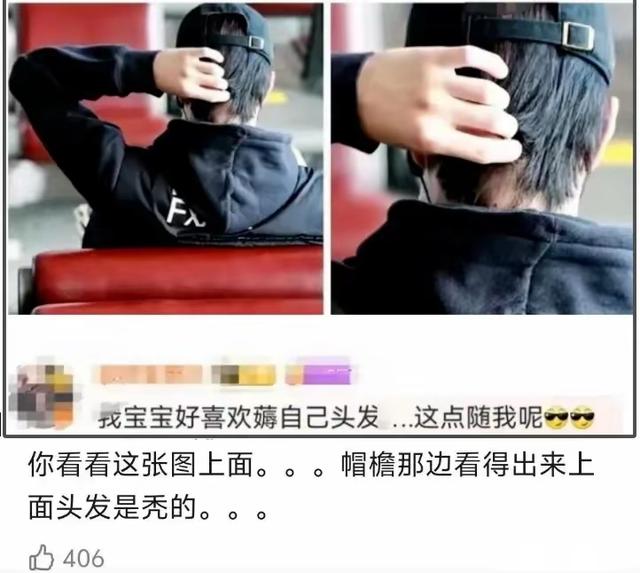 王一博400多天未进组,被拍到脱发皮肤出问题,身体状况再遭质疑