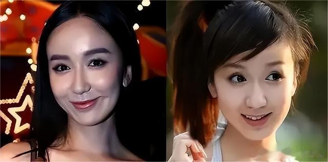 8位被整容\硅胶脸\害惨的好演员,蔡明脸肿嘴歪,刘晓庆笑不出来