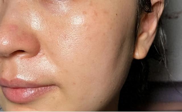 告别皮肤暗沉，教你如何美白肌肤！