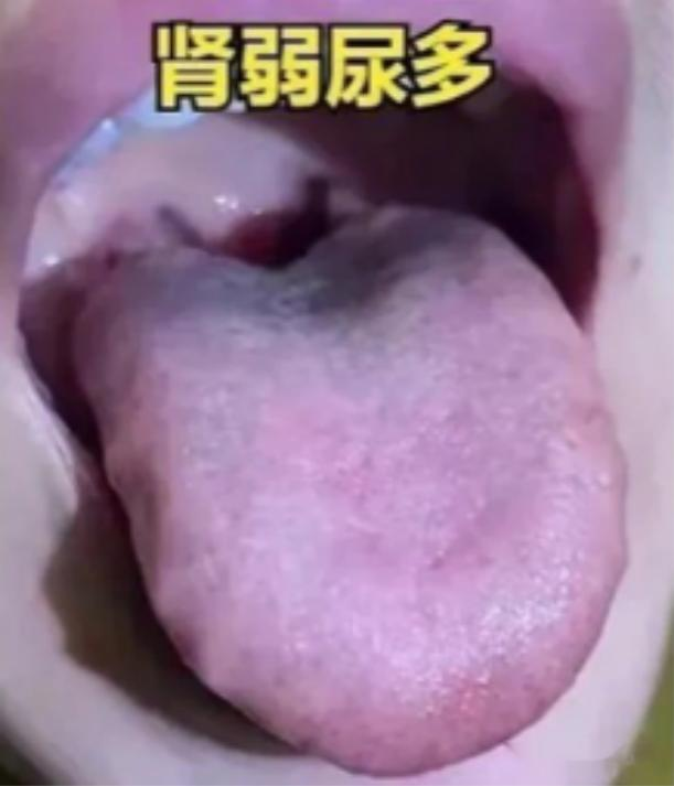 肝不好屁多、脾不好痰多、肾不好尿多，一个中成药帮你调五脏