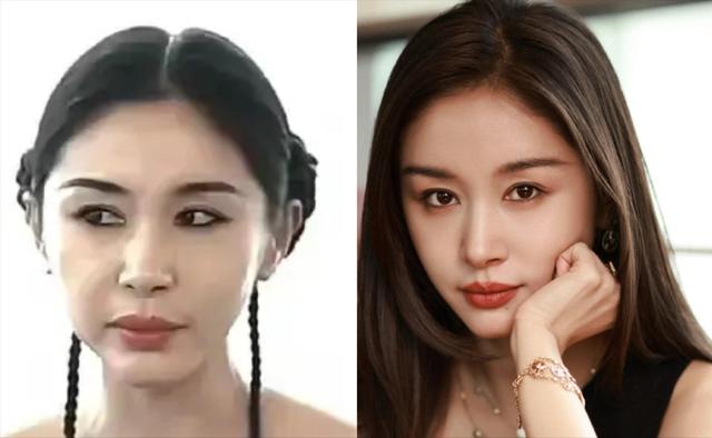 37岁王子文大变样!脸部肿胀扭曲不敢认,网友辣评:医美后遗症