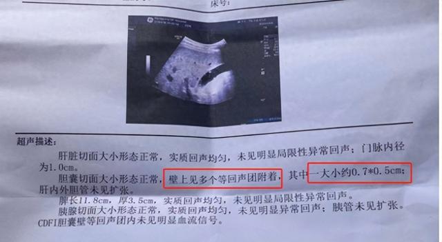 我用一斤佛手治好胆囊息肉后，不禁悲从中来：真的没有看不好的病