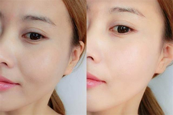 皮肤暗黄用什么牌子护肤品效果好?美白去暗黄护肤品排行榜