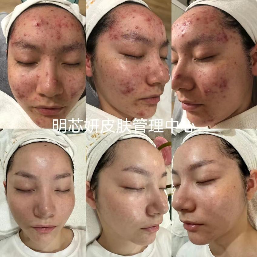 【致敬奋斗的美业青年】西部美业新青年大赛人气亚军