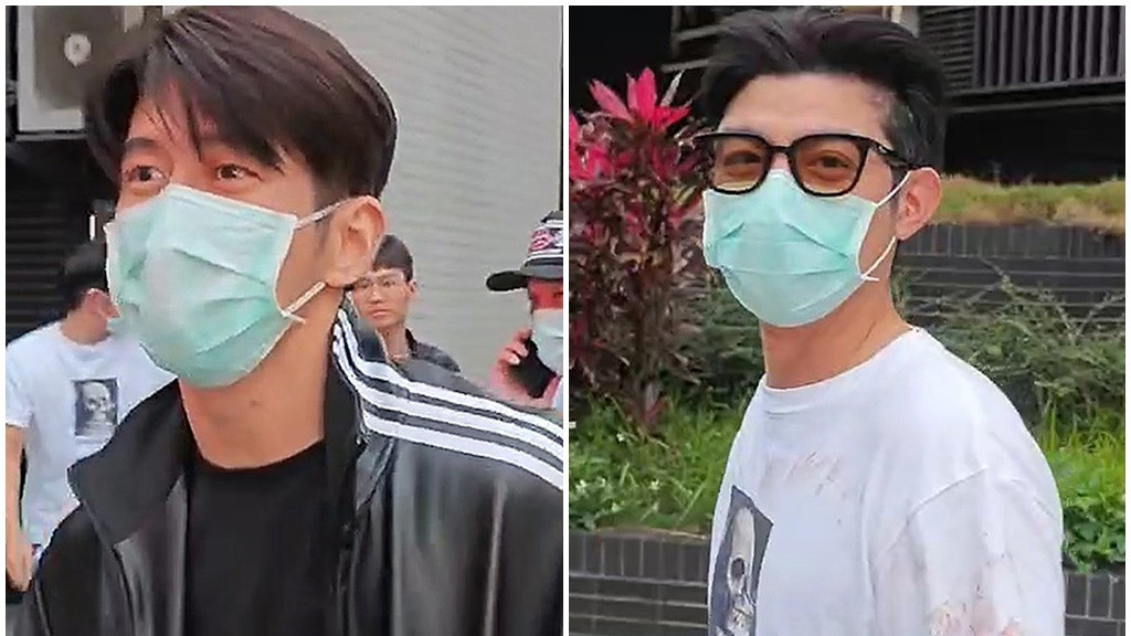 突发！贾静雯老公被带入警局，劝架被打左眼受伤充血