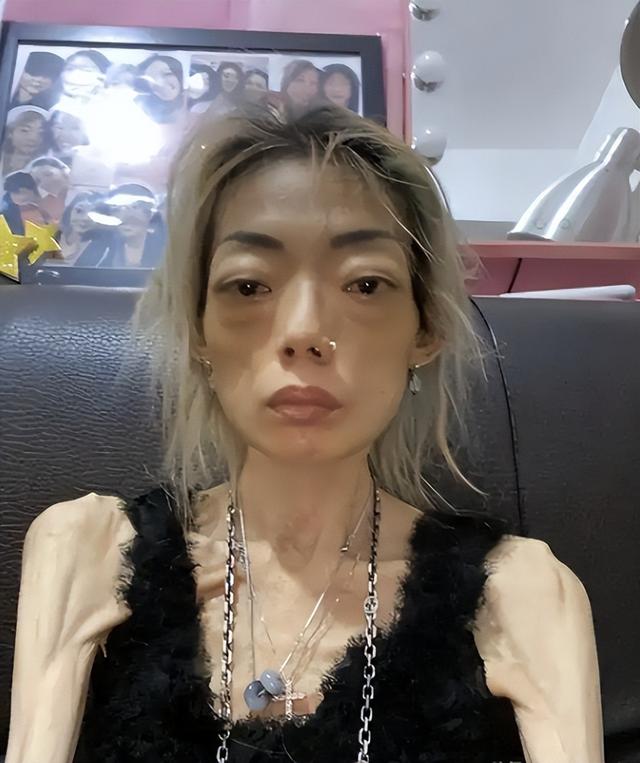 一代女神沦为豪门玩物？结婚8年牙齿全掉，器官切除，面似骷髅