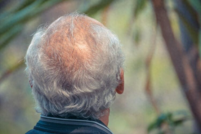 人活多久看头发能知道？医生提醒：寿命长的人，头发常有这些特征