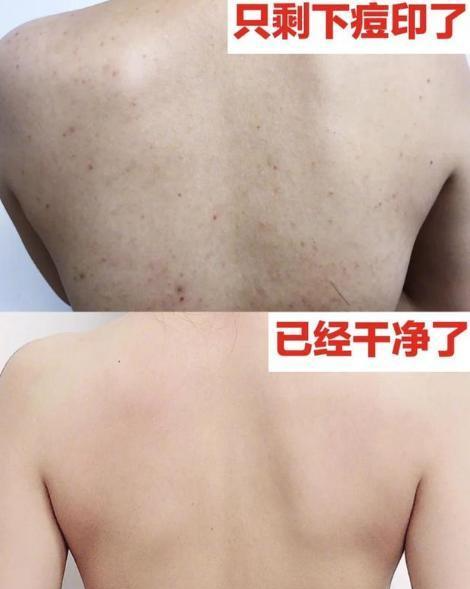 徐娇发微博晒美白成果，大方晒小肥皂，让不少网友惊“如何保养”