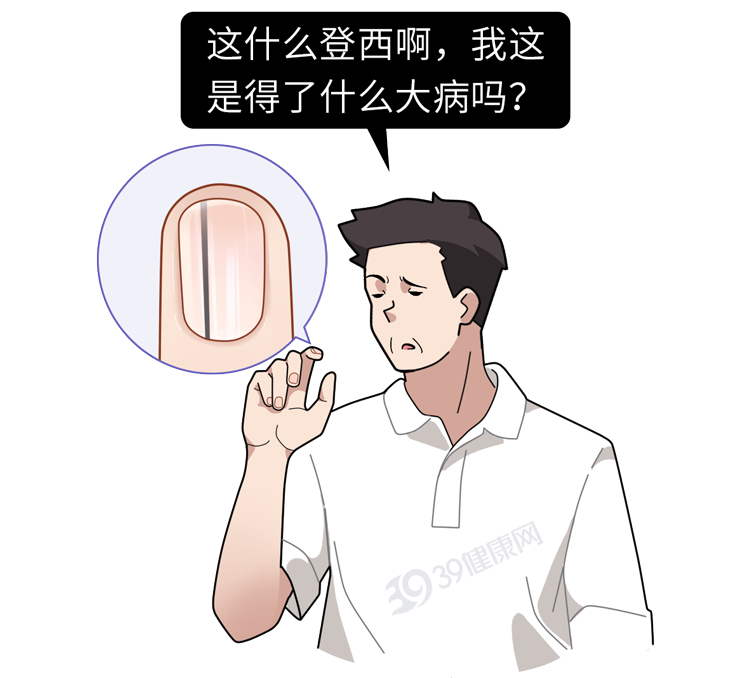 身体癌变，手部先知？提醒：若指甲出现4种异样，警惕是癌变征兆