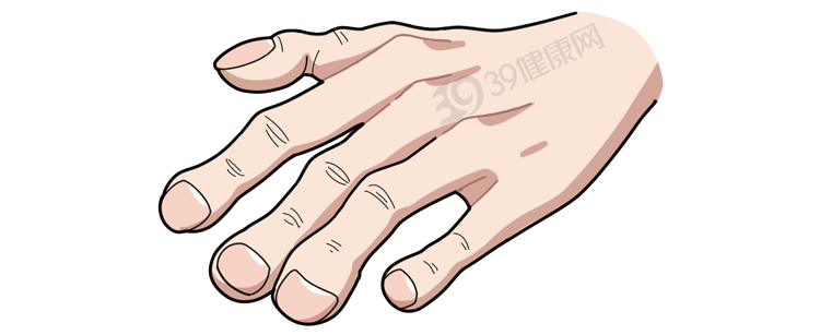 身体癌变，手部先知？提醒：若指甲出现4种异样，警惕是癌变征兆