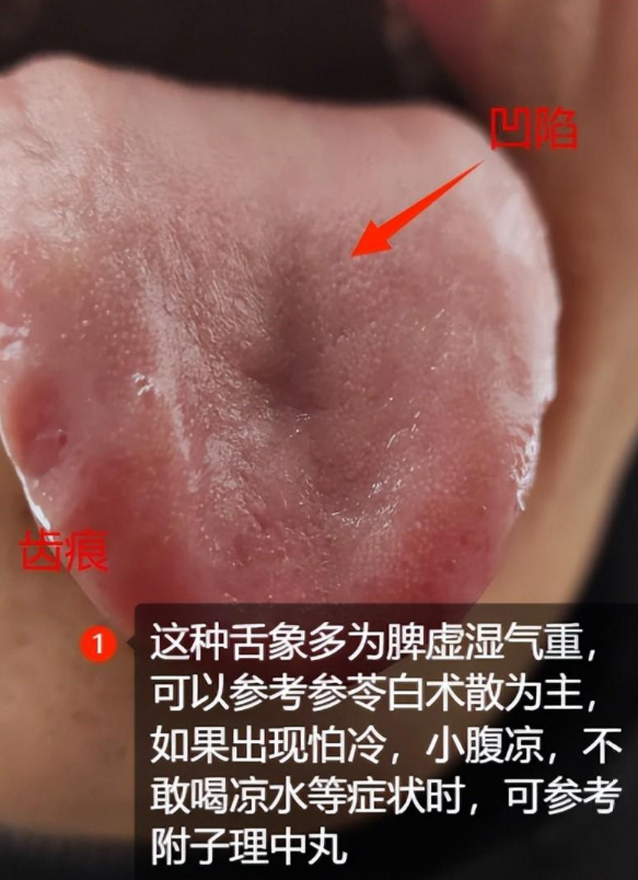 中医讲：屁多疏肝，拉稀健脾，便秘清肠