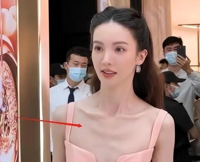 戚薇眼部状态引争议！被指撞脸刘玉玲，网友：眼角快扯到后脑勺了