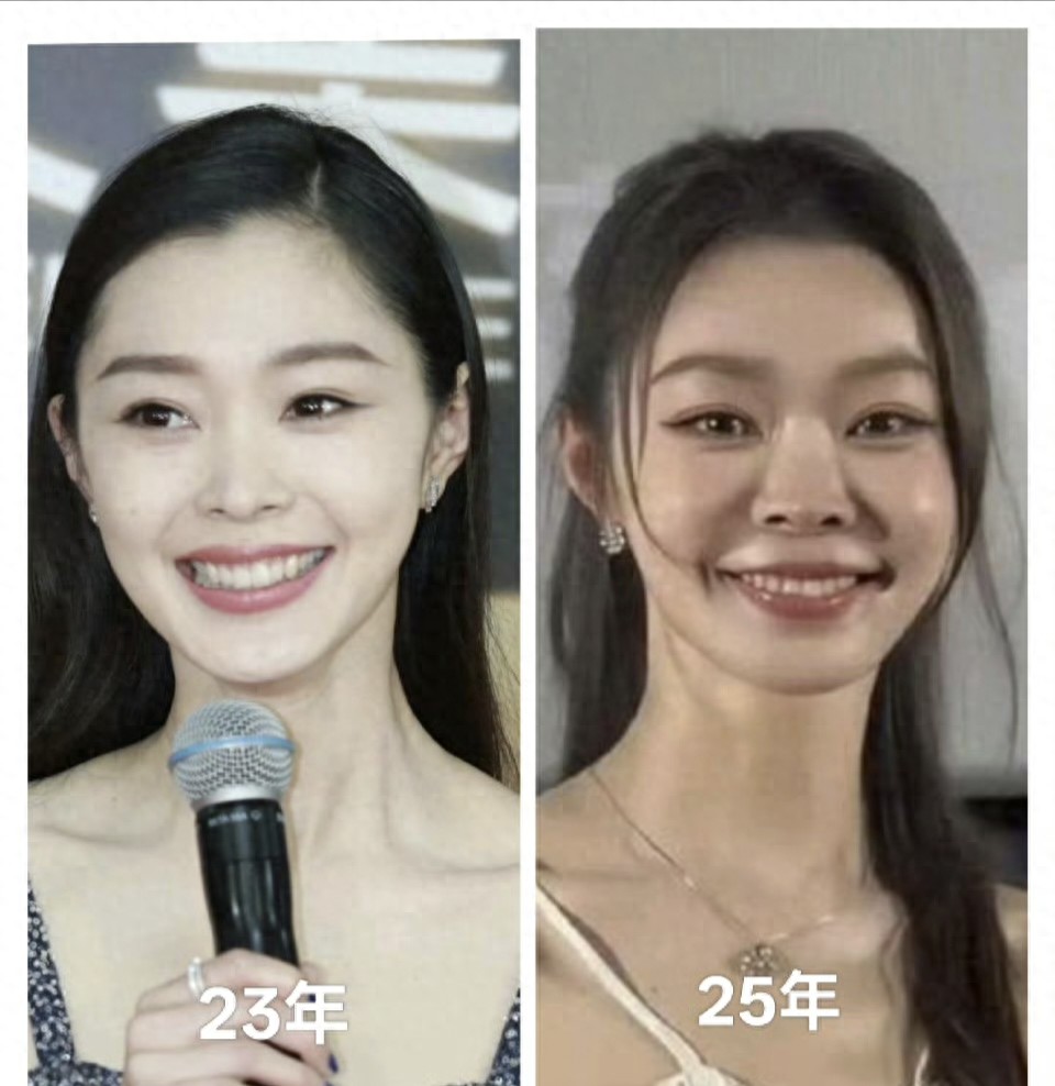 宋轶回应整容，全网沉默了，前后差距太大了，鼻子像猪鼻。