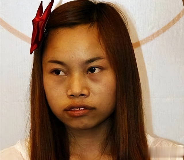 凤姐近况罕见曝光:40岁身材臃肿,牙齿脱落没钱修,后悔当初出名