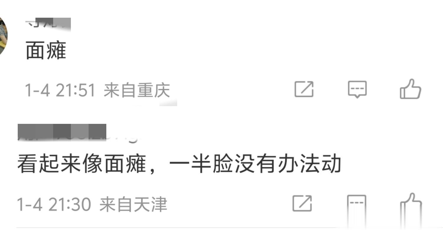 58岁王祖贤罕见露面吓坏网友：眼睛怎么这样了？整容失败！