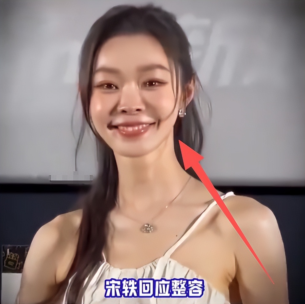 面相变了？35岁宋轶生图吓人，嘴歪脸颊僵硬,担心的事还是发生了