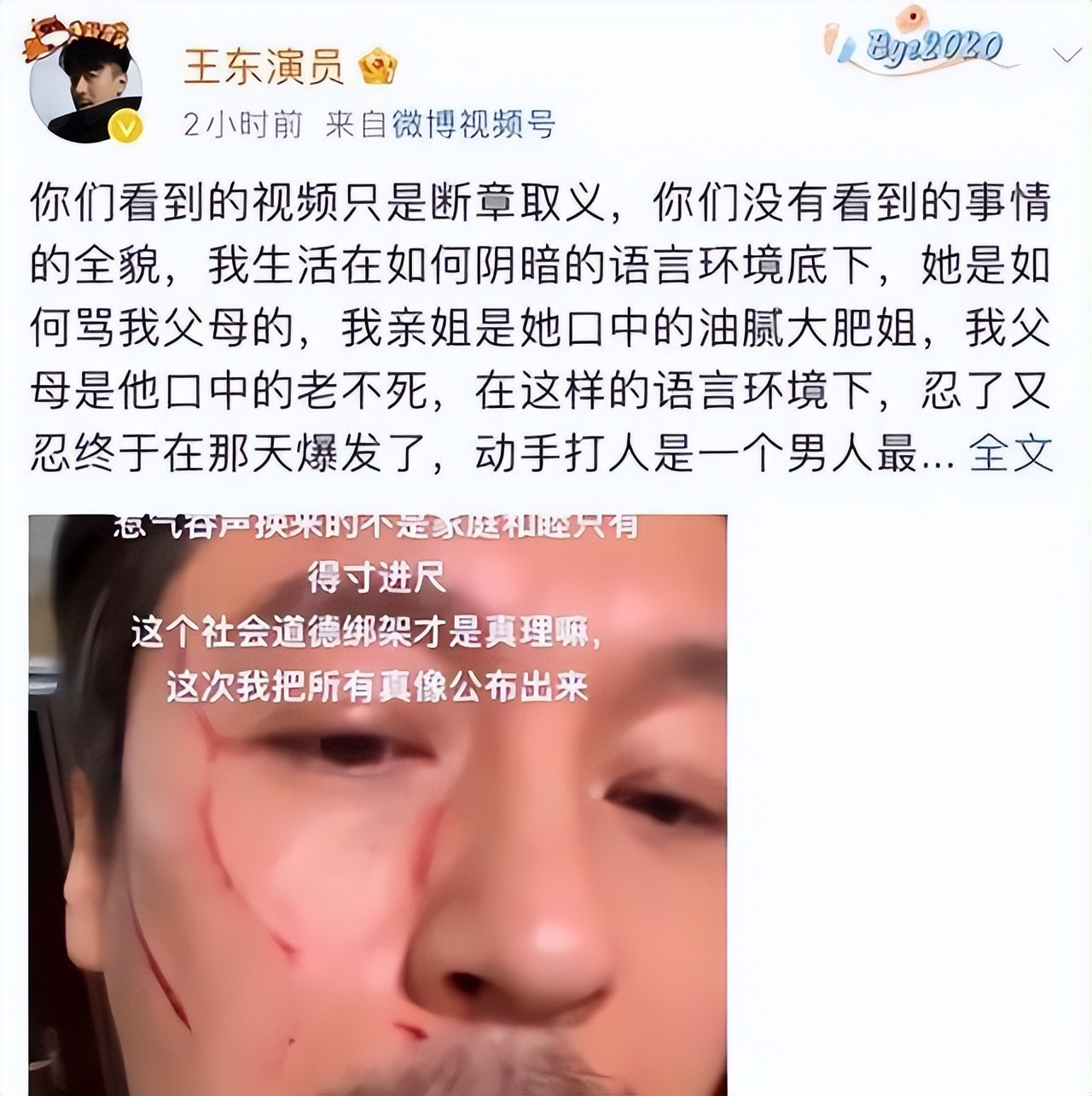 47岁知名男演员官宣离婚，为养活三个孩子直播带货，曾承认家暴