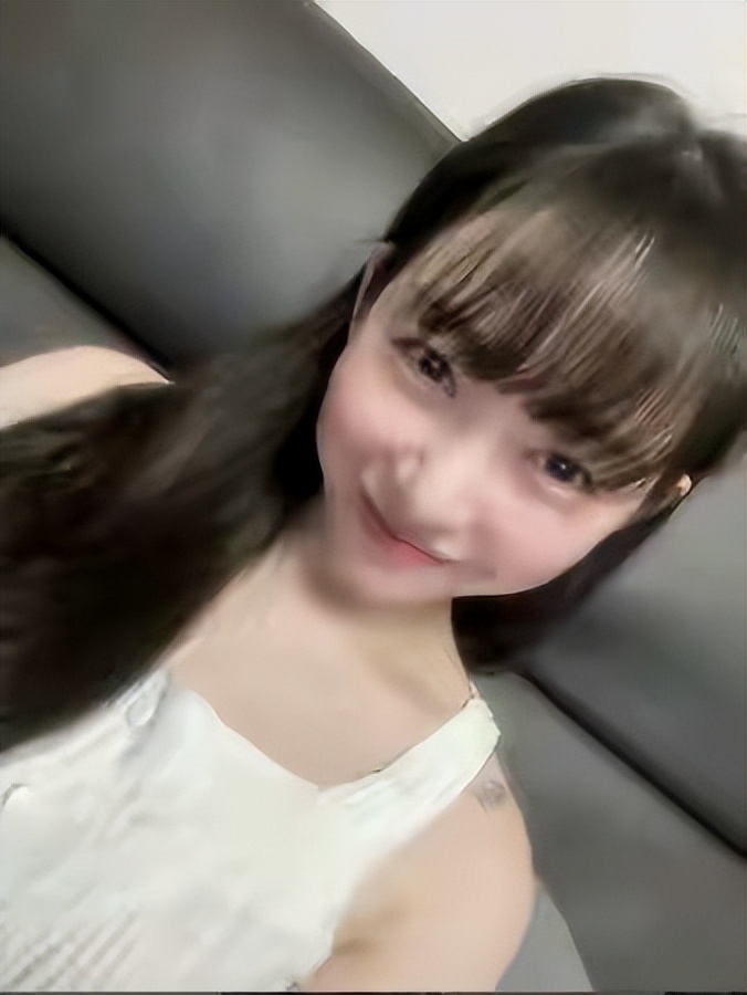 韩国歌手权珉娥自曝医美后毁容,醒来脸上撕裂般疼痛