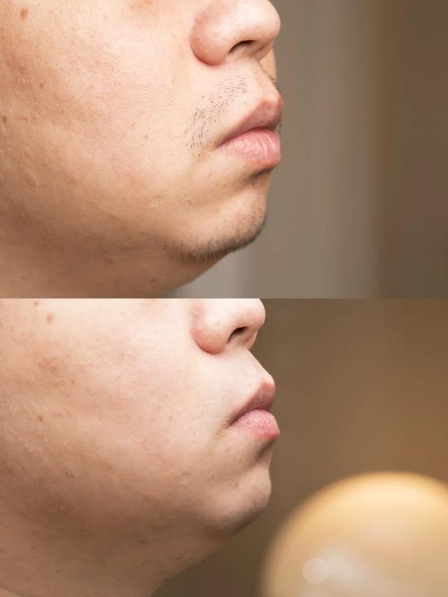 松下Air VS 徠芬T1 Pro對比實測：“撞臉”PK誰更強？