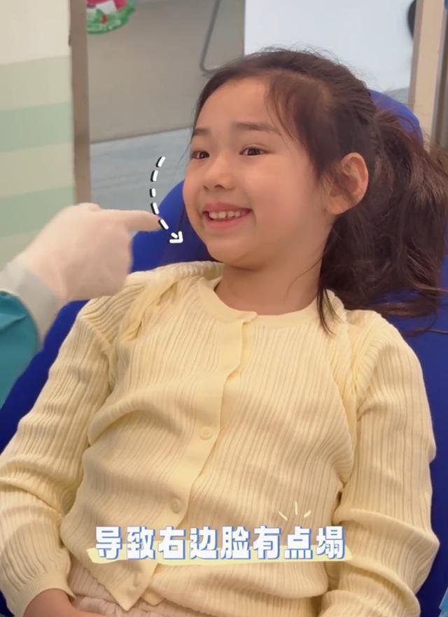 董璇自曝女儿牙齿严重深覆合，下巴后缩右边脸塌，需长期矫正