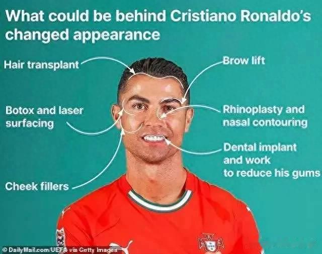 够狠!C罗为整容打断鼻梁 美国顶级整形医生:他面部基本都动过!