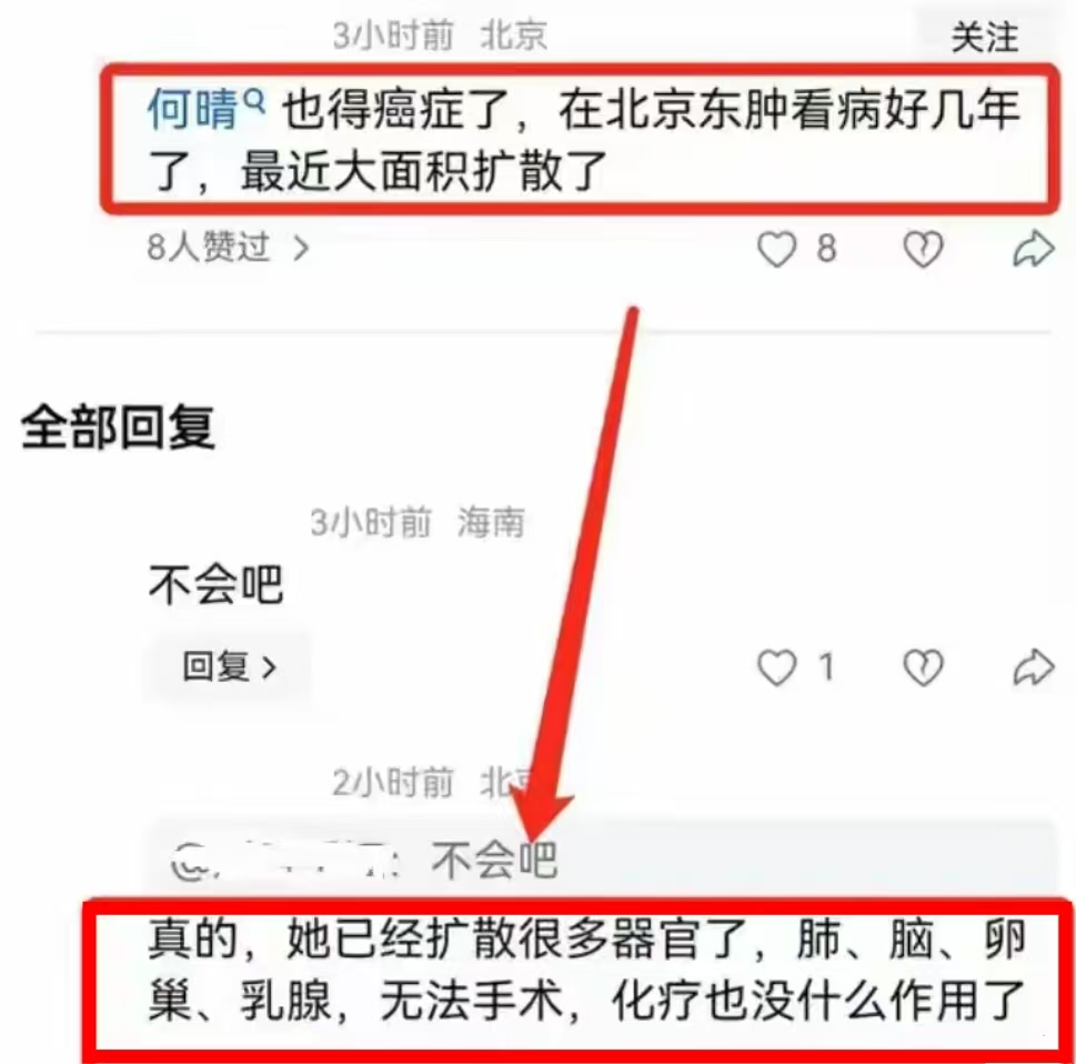 何晴父母都死于脑溢血，她也因脑瘤去世，临终前最担心儿子的健康