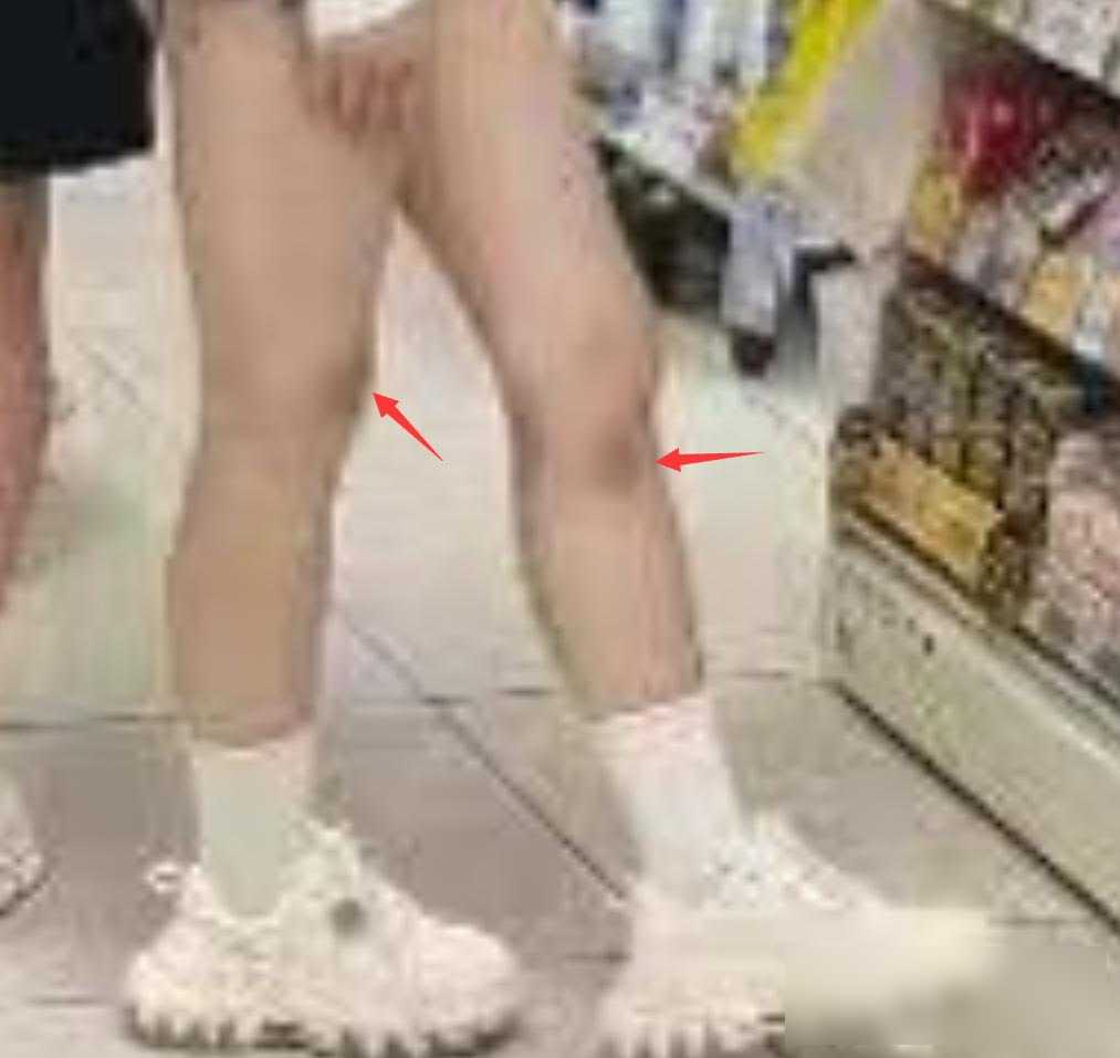 汪峰女友腿上淤青引热议，网友吐槽身材，两人新工作室暗藏玄机？