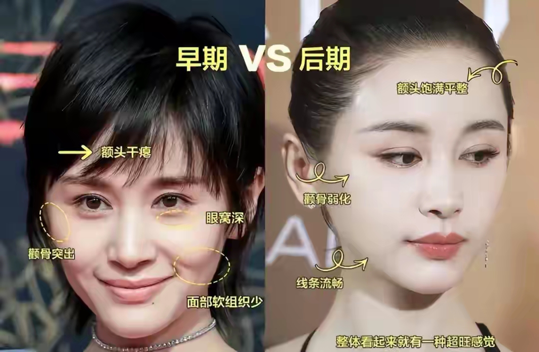 王子文美商虽高也难敌岁月，脸虽饱满但眼纹明显，短板是个子太矮