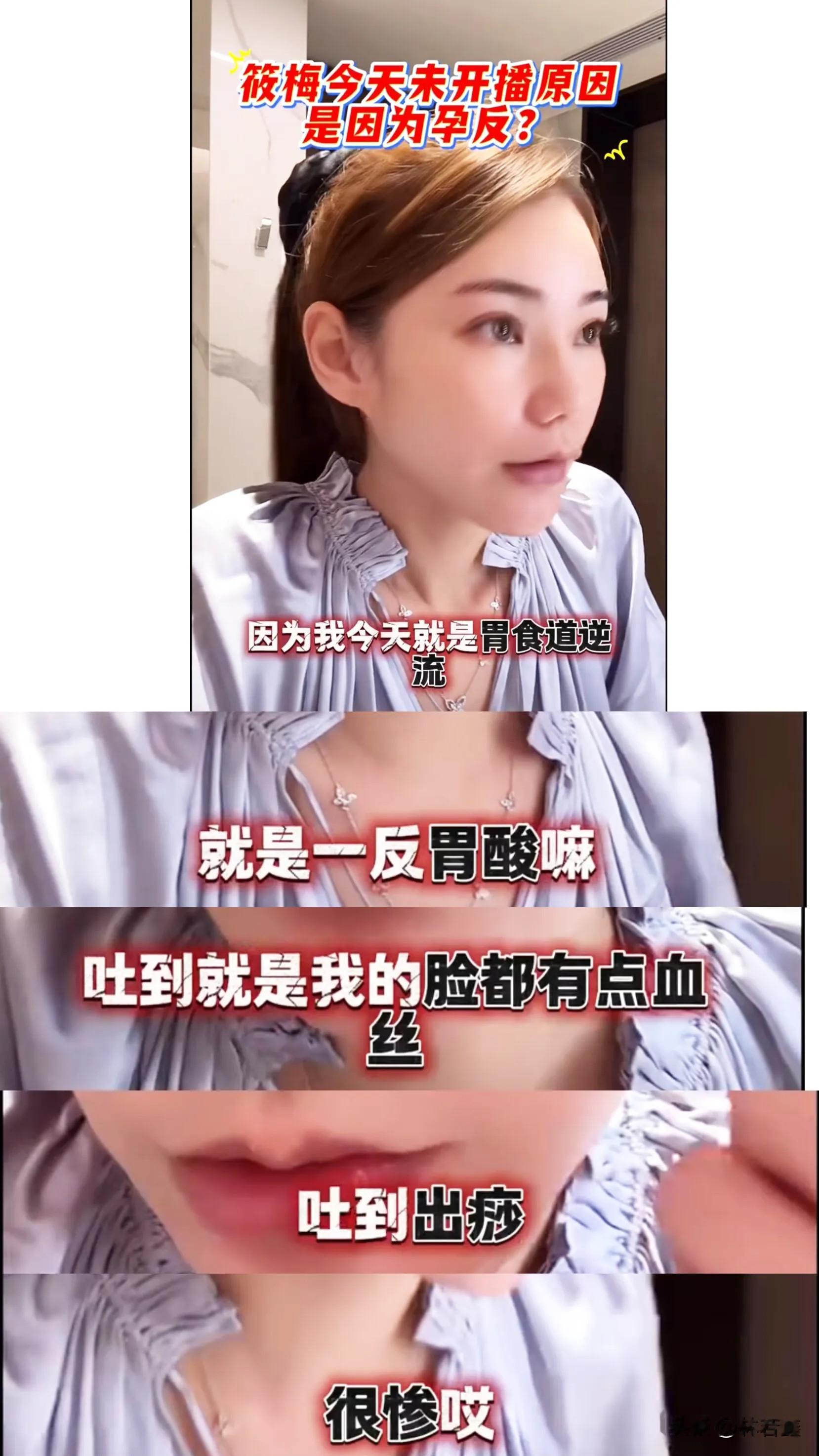 马筱梅双喜临门,直播带网友参观新家,孕吐导致脸上出现红血丝!