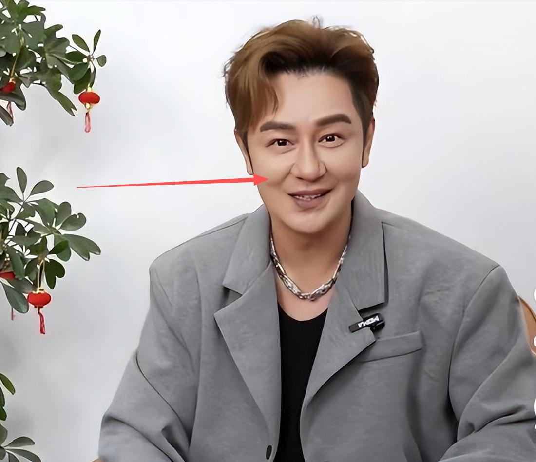 56岁陈浩民近照曝光，过度医美仍盖不住脸上的斑，皮肤差到不敢认