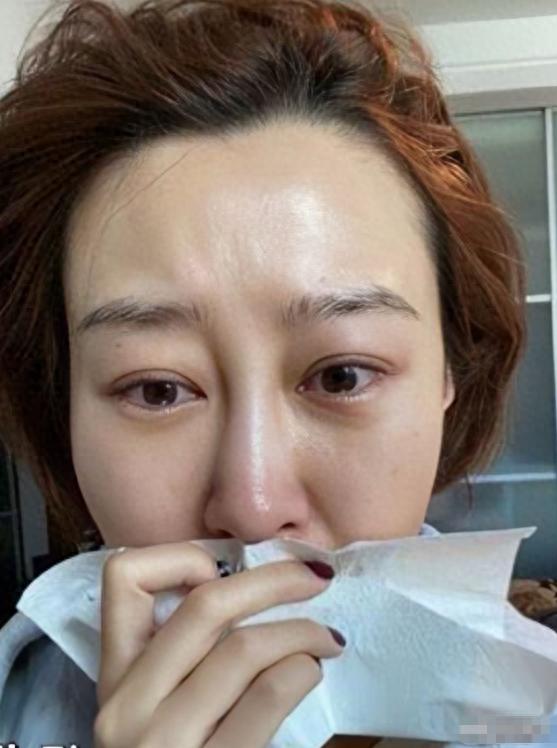 满是心酸！38岁过气女星失业，住80平出租屋，下巴也被玻尿酸打坏