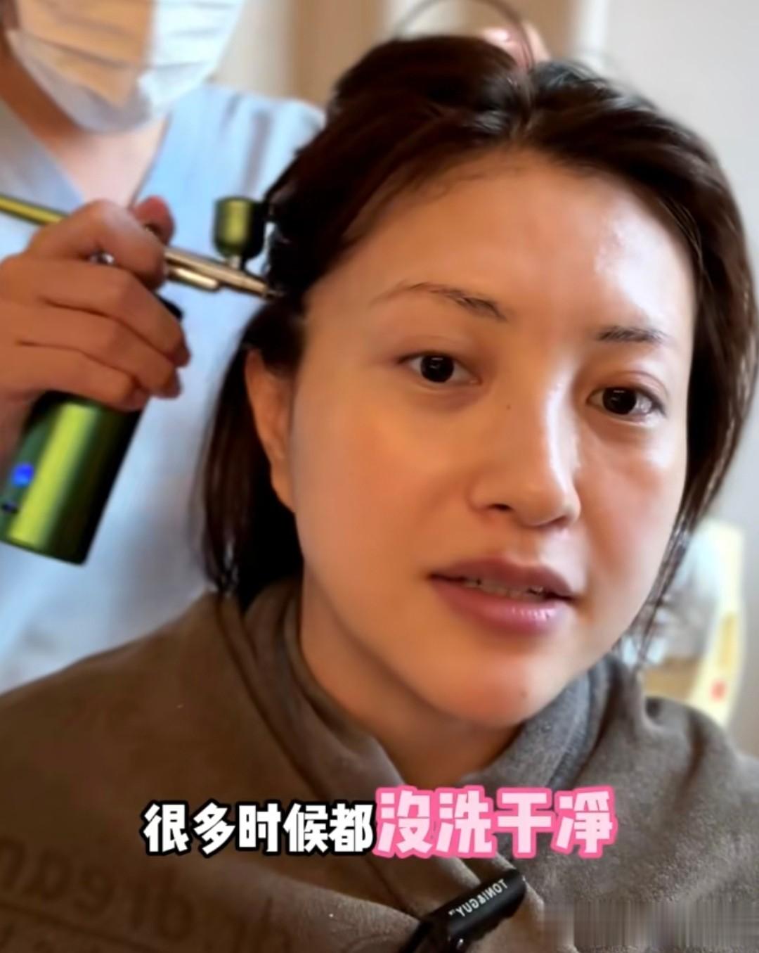 包贝尔老婆去做医美，包文婧晒纯素颜，38岁生完二胎脸往下垮了