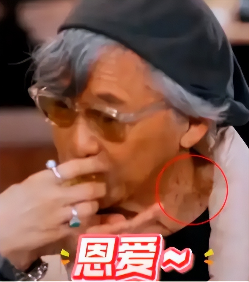 香港著名男星颈部现斑点，进食时眼神涣散，粉丝担心演唱会强度