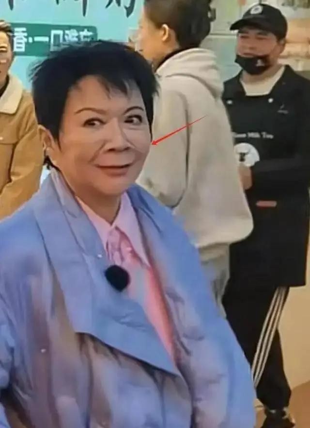 瘦到见骨、全身涂白、假牙泛滥，女明星自残式内卷何时到尽头