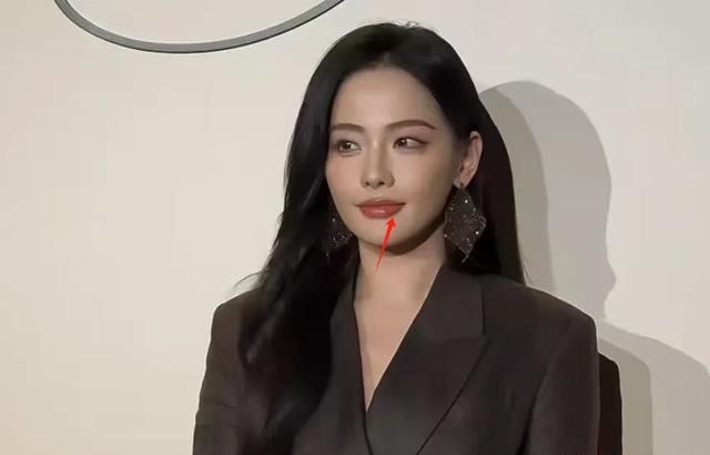 37岁张嘉倪复出首秀变化大！五官轮廓神似刘诗诗，还被质疑丰唇