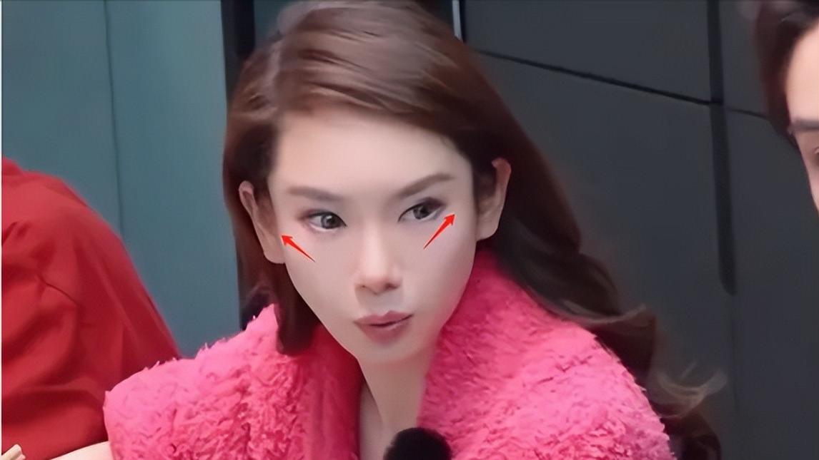 戚薇上节目被质疑医美过度，浮肿吊眼梢，细扒变脸史，越看越别扭